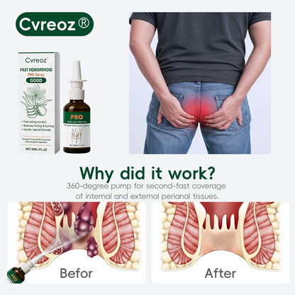 🎉Best Seller🎉Cvreoz® Fast Hemorrhoid PRO Spray