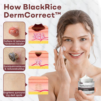 🌿Healrize® BlackRice DermCorrect™ Wart Recovery Cream| Suitable for all skin types