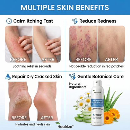 👨‍⚕️🔥Healrize® Magnesium Botanical Spray – Advanced Skin Recovery for Psoriasis & Eczema | Rapid Soothing, Steroid-Free 🌿