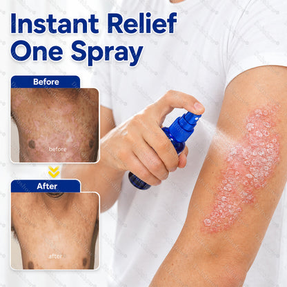 🔥Dobshow® Advanced Psoriasis Relief Spray