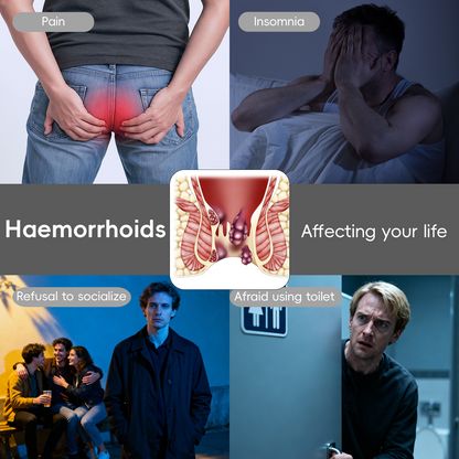 🎉Best Seller🎉Cvreoz® Fast Hemorrhoid PRO Spray