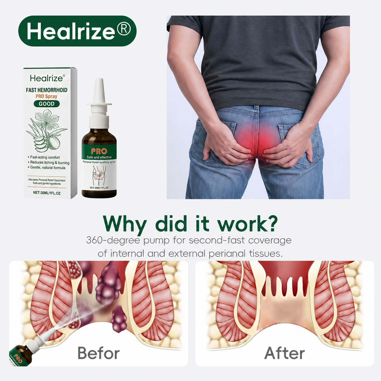 🌿🔥Healrize® Fast Hemorrhoid PRO Spray