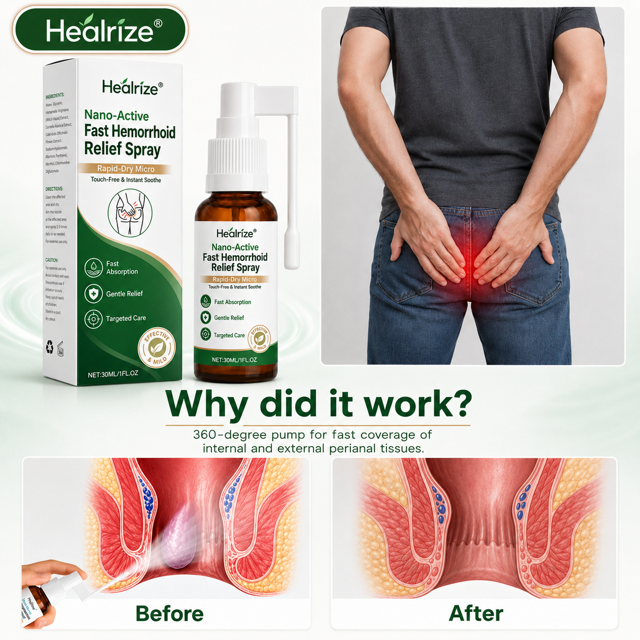 🌿Healrize® Nano-Active Fast Hemorrhoid Relief Spray