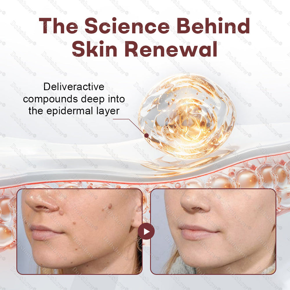 🌿Healrize® BlackRice DermCorrect™ Wart Recovery Cream| Suitable for all skin types