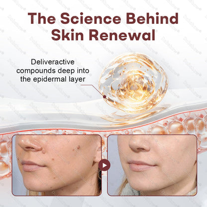 🌿Healrize® BlackRice DermCorrect™ Wart Recovery Cream| Suitable for all skin types