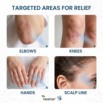👨‍⚕️🔥Healrize® Magnesium Botanical Spray –✅Advanced Skin Recovery for Psoriasis & Eczema | Rapid Soothing, Steroid-Free🌿