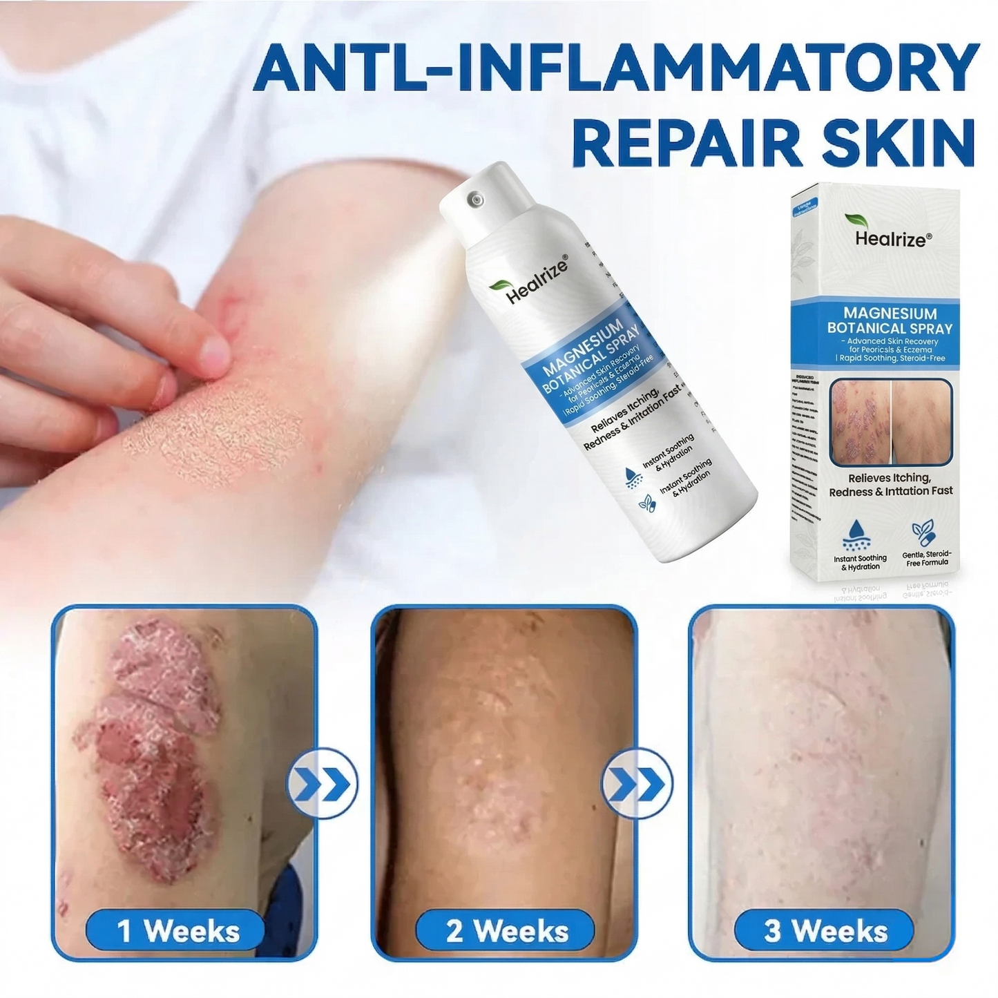 👨‍⚕️🔥Healrize® Magnesium Botanical Spray – Advanced Skin Recovery for Psoriasis & Eczema | Rapid Soothing, Steroid-Free 🌿