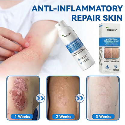 👨‍⚕️🔥Healrize® Magnesium Botanical Spray –✅Advanced Skin Recovery for Psoriasis & Eczema | Rapid Soothing, Steroid-Free🌿