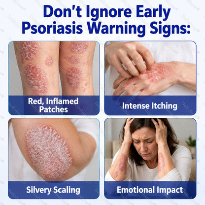🔥Dobshow® Advanced Psoriasis Relief Spray